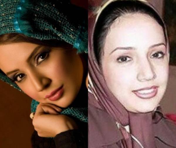 عکس شبنم قلی خانی قبل و بعد از عمل