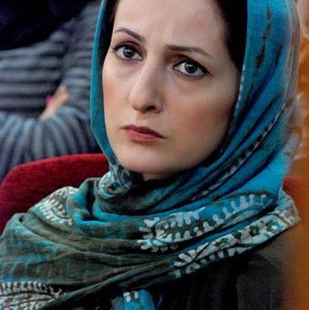 عکس شقایق دهقان قبل از عمل زیبایی