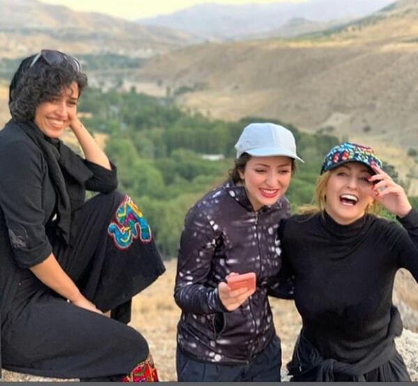 عکس شقایق دهقان قبل از عمل زیبایی