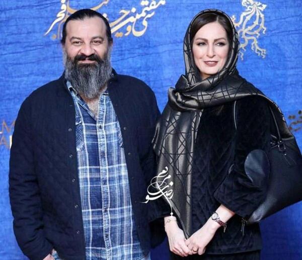عکس شقایق دهقان قبل از عمل زیبایی