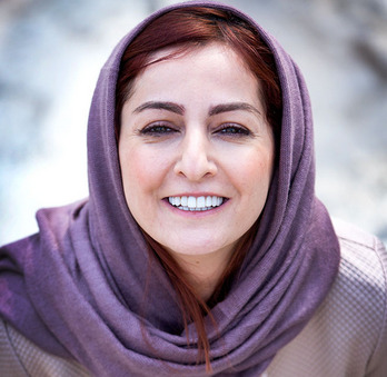 عکس شقایق دهقان قبل از عمل زیبایی