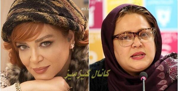 عکس بهاره رهنما قبل از عمل زیبایی