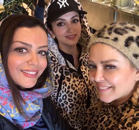 عکس بهاره رهنما قبل از عمل زیبایی