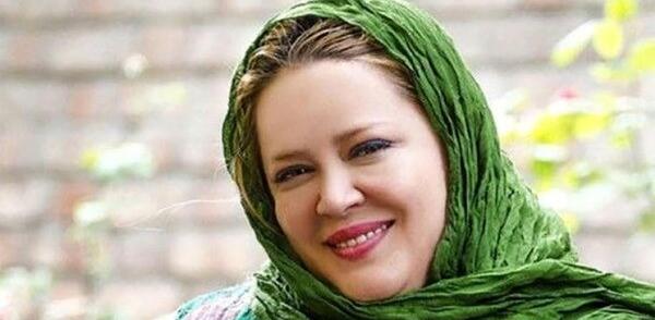 عکس بهاره رهنما قبل از عمل زیبایی