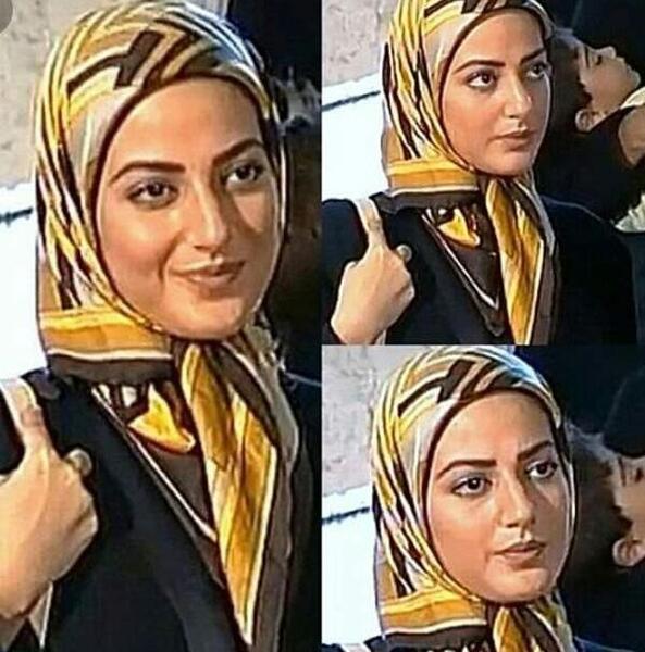 عکس طناز طباطبایی قبل و بعد عمل