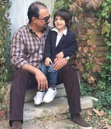 عکس برزو ارجمند قبل از عمل