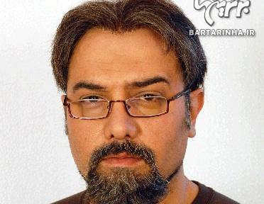 عکس برزو ارجمند قبل از عمل