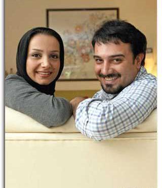 عکس برزو ارجمند قبل از عمل