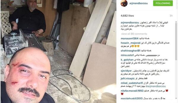 عکس برزو ارجمند قبل از عمل