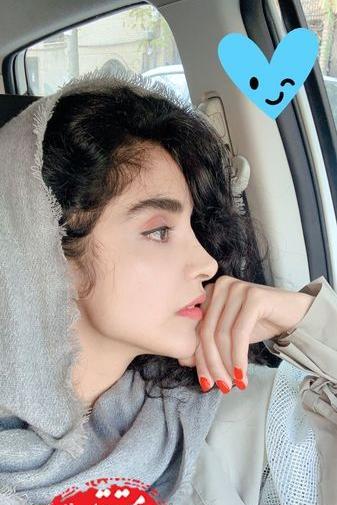 عکس الهه حصاری قبل از عمل بینی