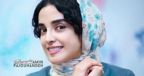 عکس الهه حصاری قبل از عمل بینی