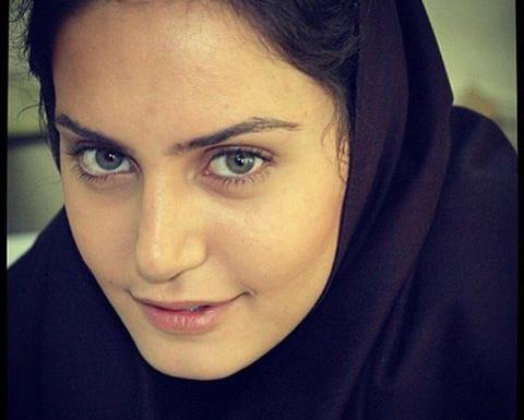 عکس الناز شاکردوست قبل از عمل جراحی زیبایی