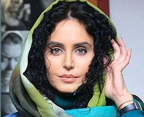 عکس الناز شاکردوست قبل از عمل جراحی زیبایی