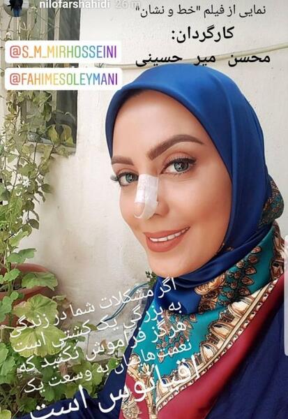 عکس حمیرا ریاضی قبل از عمل بینی