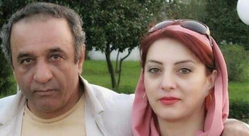 عکس حمیرا ریاضی قبل از عمل بینی