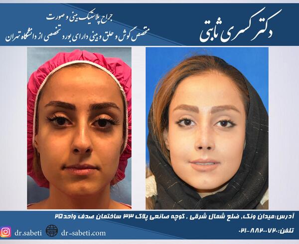 عکس کاشت گونه