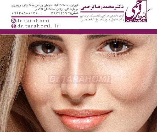 عکس کاشت گونه