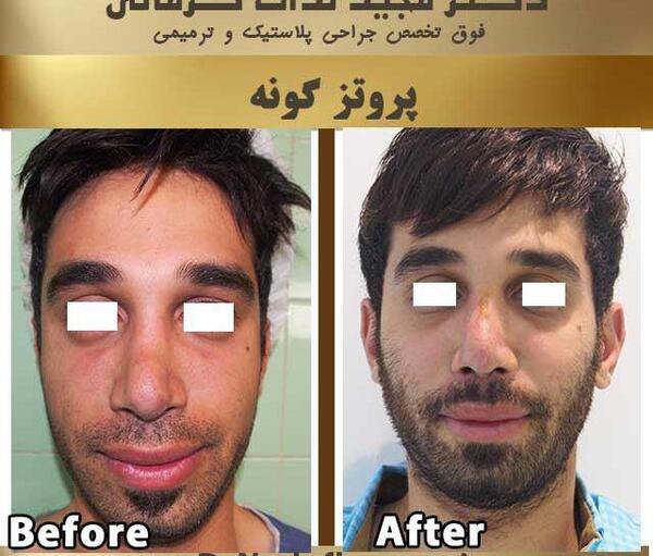 عکس کاشت گونه