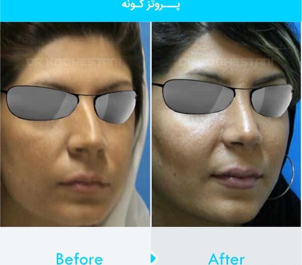 عکس کاشت گونه