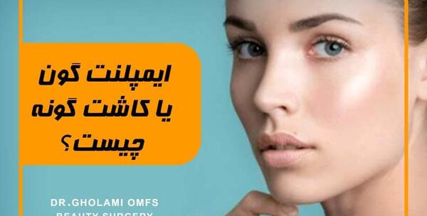 عکس کاشت گونه