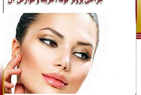 عکس کاشت گونه