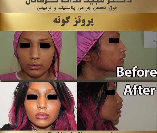 عکس کاشت گونه