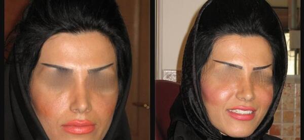 عکس کاشت گونه