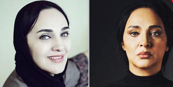 عکس رویا نونهالی قبل از عمل زیبایی