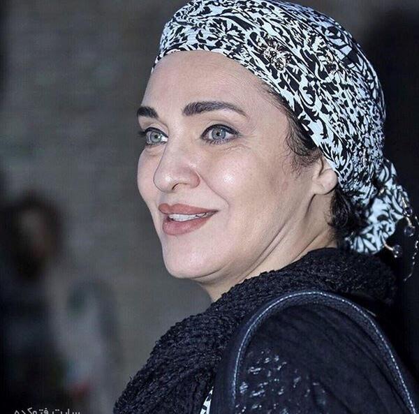 عکس رویا نونهالی قبل از عمل زیبایی