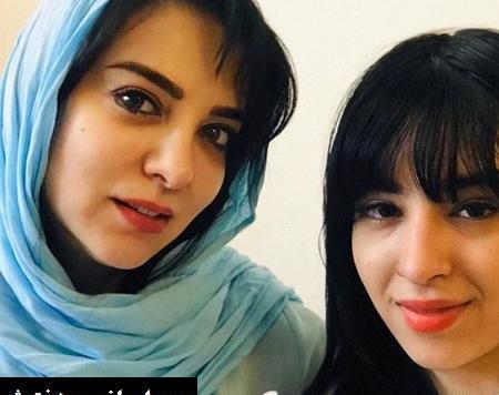 عکس حمیرا ریاضی قبل و بعد از عمل زیبایی