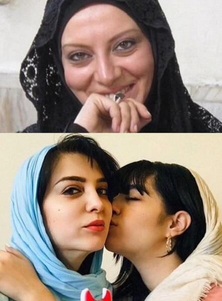 عکس حمیرا ریاضی قبل و بعد از عمل زیبایی