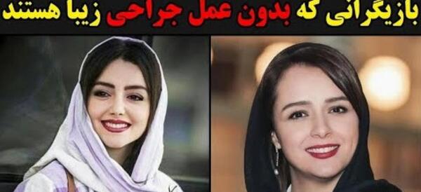 عکس شاهرخ استخری قبل از جراحی بینی