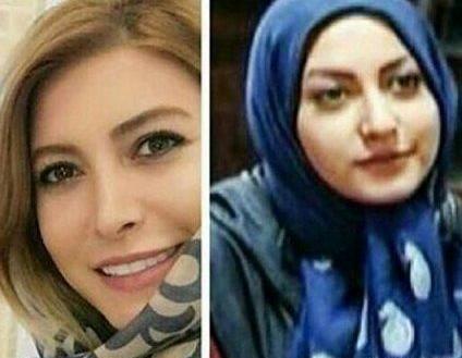 عکس شاهرخ استخری قبل از جراحی بینی