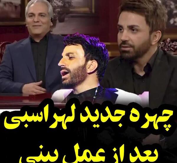 عکس شاهرخ استخری قبل از جراحی بینی