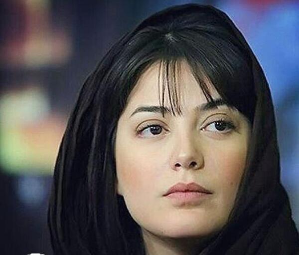عکس طناز طباطبایی قبل عمل بینی