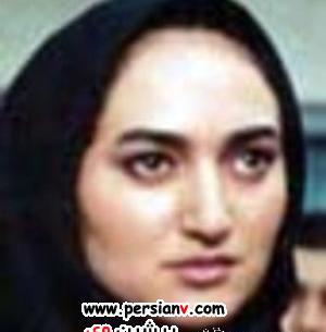 عکس آنا نعمتی قبل عمل بینی