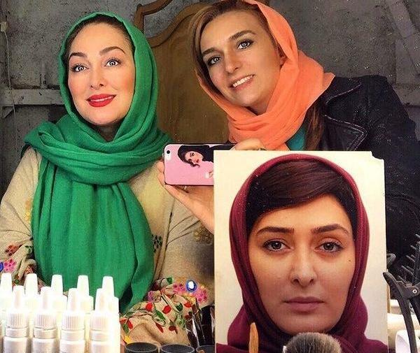 عکس الهام حمیدی قبل و بعد از عمل بینی