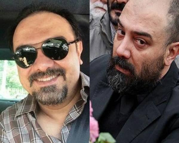 عکس برزو ارجمند قبل و بعد از کاشت مو