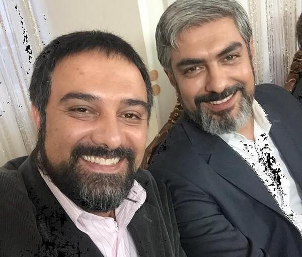 عکس برزو ارجمند قبل و بعد از کاشت مو