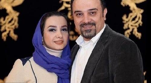 عکس برزو ارجمند قبل و بعد از کاشت مو