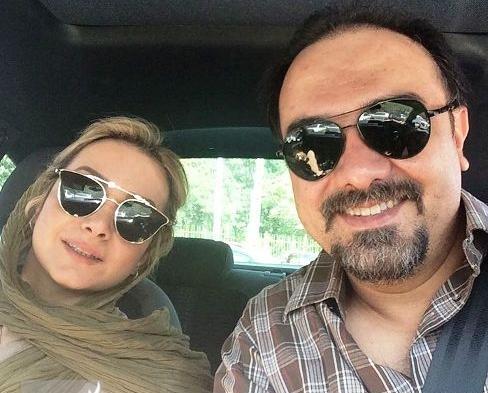 عکس برزو ارجمند قبل و بعد از کاشت مو