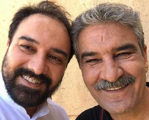 عکس برزو ارجمند قبل و بعد از کاشت مو