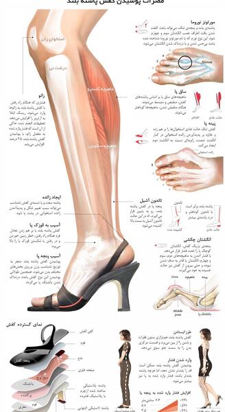 عکس الناز شاکردوست با کفش پاشنه بلند
