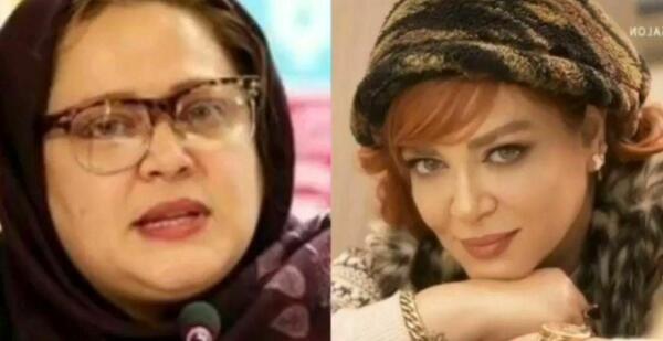عکس بهاره رهنما قبل و بعد از عمل