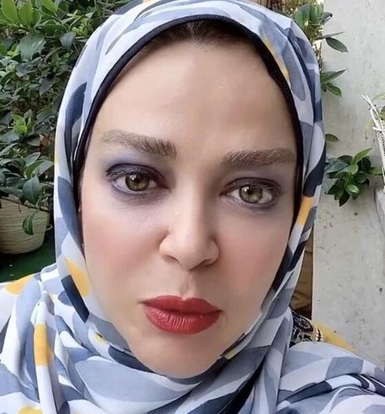 عکس بهاره رهنما قبل و بعد از عمل