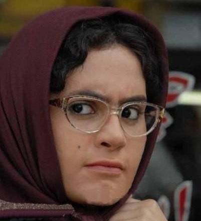 عکس الناز شاکر دوست قبل از عمل زیبایی