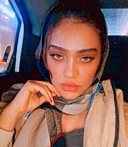 عکس همسر قائدی قبل از عمل
