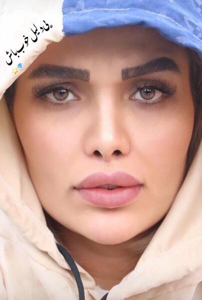 عکس همسر قائدی قبل از عمل