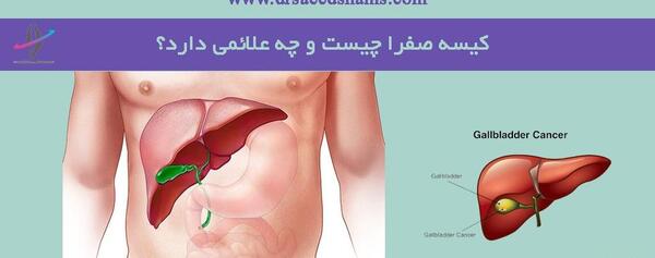 عکس سنگ صفرا در بدن