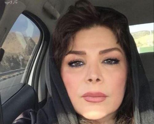 عکس قبل عمل شیوا خنیاگر
